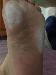 国产脚底角质去除视频,国产去角质视频教程大揭秘